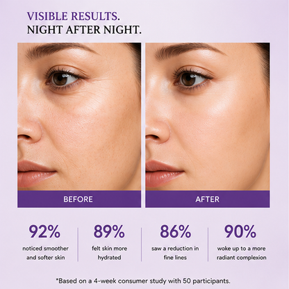 ZALORE™ Overnight Renewal Night Cream | Deep Hydration & Skin Nourishment | 50g