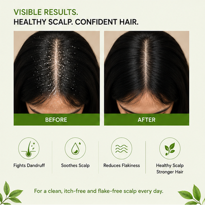 ZALORE™ Anti-Dandruff Shampoo | Flake Control & Scalp Refresh Care | 200ml