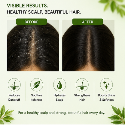 ZALORE™ Anti-Dandruff Conditioner | Scalp Care & Hair Nourishment | 200ml