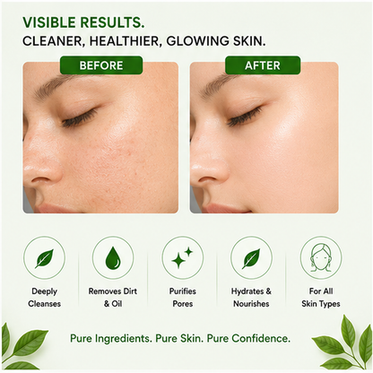ZALORE™ Green Tea Purifying Face Wash | Deep Cleanse & Oil Control | 100ml