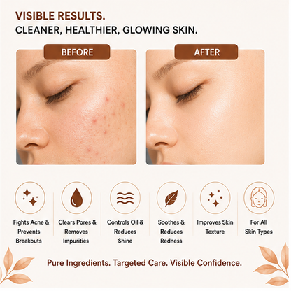 ZALORE 1% Salicylic Acid Face Wash for Acne & Oil Control, Deep Cleansing Facial Cleanser Helps Remove Excess Oil & Impurities for Clear Skin, 100ml