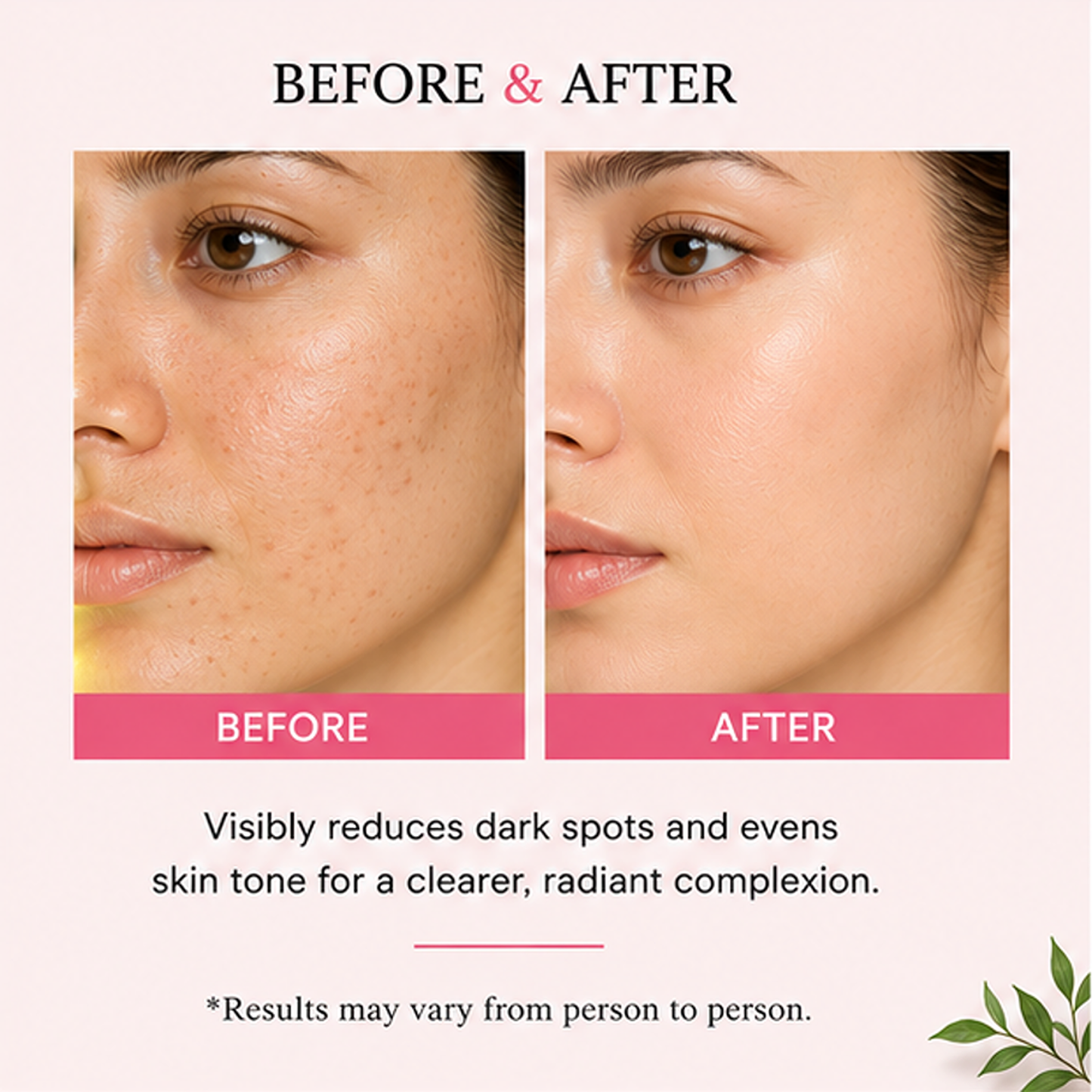 zalore™ spot correcting face serum | clear skin & radiant glow care | 30ml