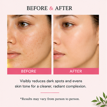 ZALORE™ Spot Correcting Face Serum | Clear Skin & Radiant Glow Care | 30ml