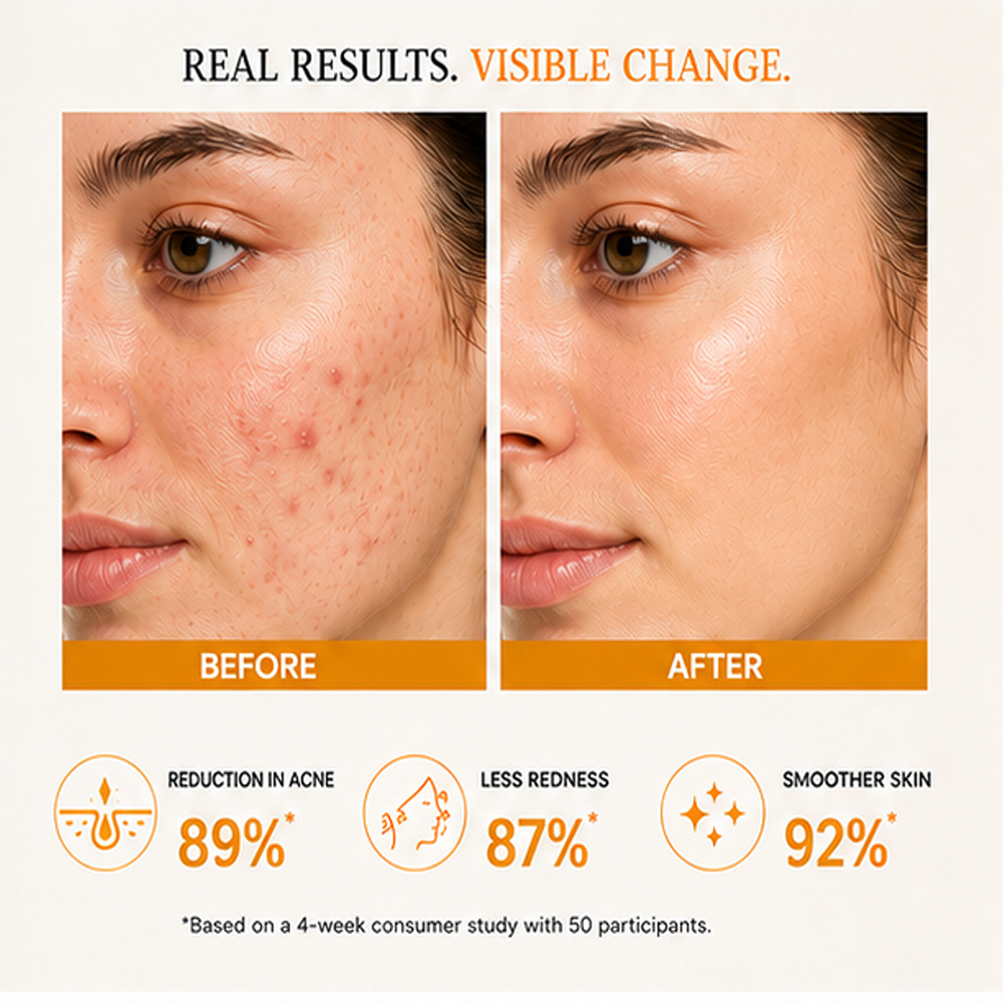 zalore™ 1% salicylic acid clarifying serum | acne control & pore refining care | 30ml